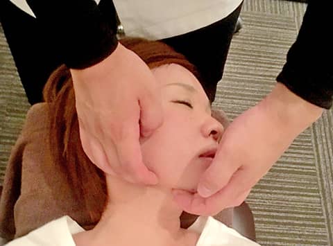 顔面矯正